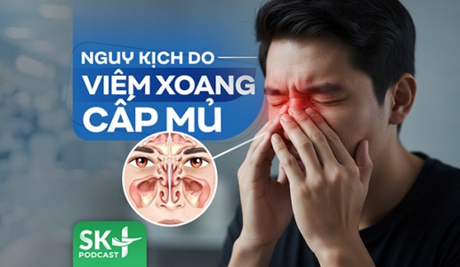 Podcast: Nguy kịch do viêm xoang cấp mủ