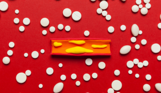 Thói quen tưởng tốt nhưng lại góp phần gây tắc mạch vành