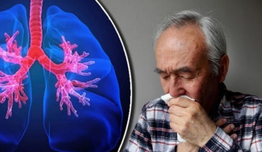 Người bị viêm phổi mạn tính nên điều trị như thế nào?