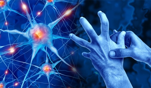 Run tay chân do thoái hóa não, dùng thuốc không cải thiện phải làm sao?