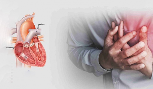 Hẹp van tim do thấp tim: Nguy cơ tiềm ẩn ở người trẻ