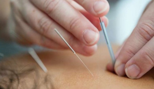 Châm cứu giúp bệnh nhân ung thư vú vượt qua chứng 'sương mù não'