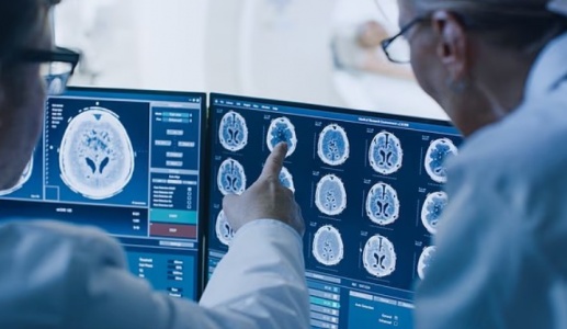 Thói quen có thể giúp “trẻ hóa” não bộ