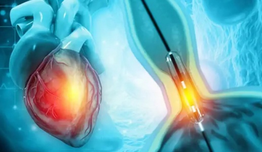 Hẹp mạch vành sau khi điều trị có tự hồi phục hoàn toàn không?