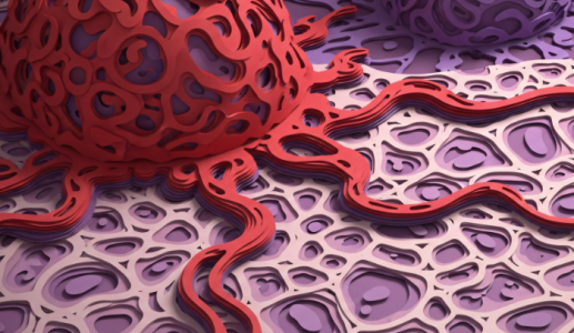 Biểu hiện của khối u ác tính như thế nào?