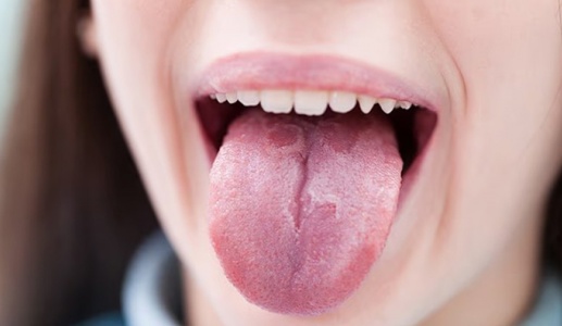 Thủ phạm “quen mặt” tăng nguy cơ ung thư miệng lên 50%