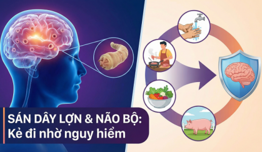 Chuyên gia WHO chỉ cách phòng ngừa bệnh sán dây lợn