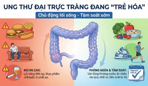 Khi nào người trẻ cần đi tầm soát ung thư đại trực tràng?