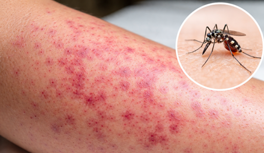 Bộ Y tế: Nguy cơ gia tăng dịch bệnh dịp sát Tết