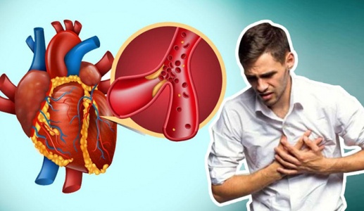 Thói quen hàng ngày đang âm thầm “tàn phá” sức khỏe tim 