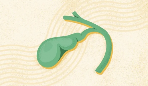 Có sỏi mật 15mm, hay bị đau hạ sườn phải nên xử trí thế nào?