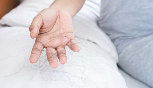 Vỏ gối và thói quen ngủ có liên quan đến rụng tóc?