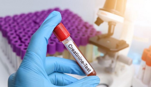 Tại sao chỉ số creatinin lúc tăng lúc giảm?
