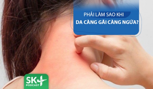 Podcast: Da bị ngứa càng gãi càng ngứa - Làm thế nào?