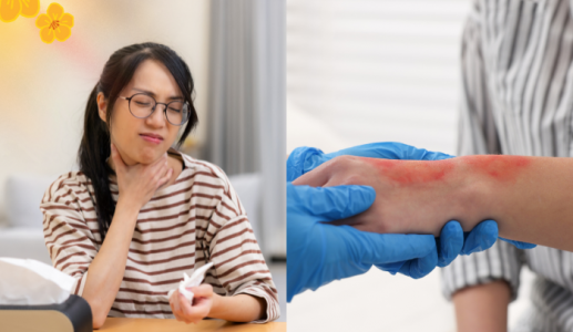 Infographic: Những bước sơ cứu cơ bản tại nhà ngày Tết