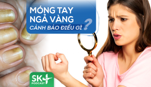 Podcast: Móng tay ngả vàng cảnh báo vấn đề gì?