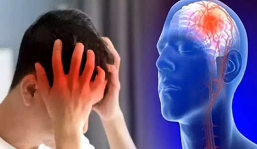 Tai biến mạch máu não có mấy loại?