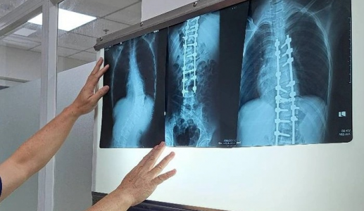 Chụp X-quang không đủ 6 phút bị từ chối thanh toán BHYT, Bộ Y tế vào cuộc