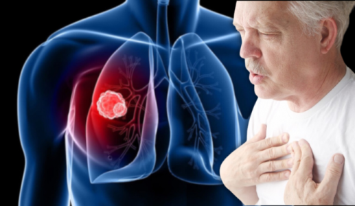 Cách kiểm soát triệu chứng khó thở do u phổi