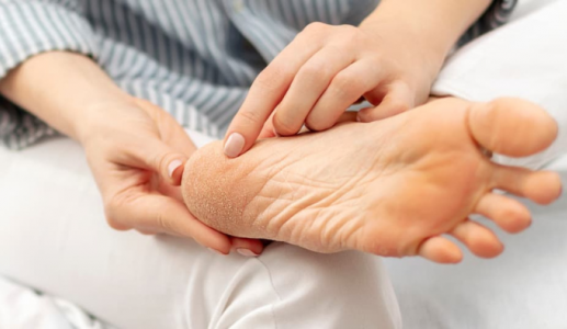 Cải thiện tình trạng nứt nẻ gót chân trong 4 bước