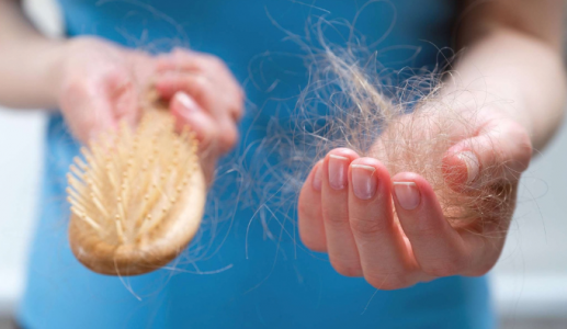 Nhận biết sớm dấu hiệu rụng tóc và cách hạn chế