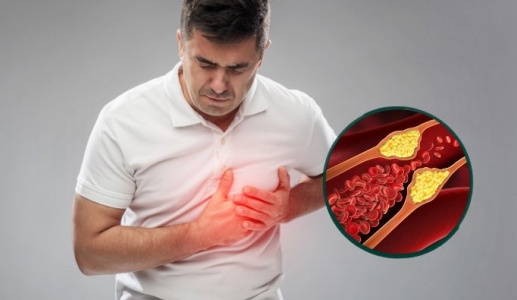 Lầm tưởng thường gặp về cholesterol