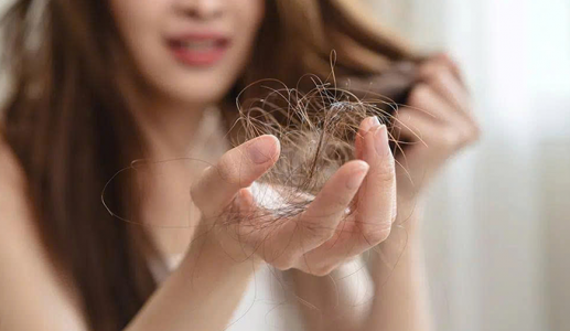 Căng thẳng có thể gây rụng tóc?