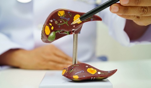 Tổng quan về sỏi đường mật trong gan: Những điều bạn cần biết