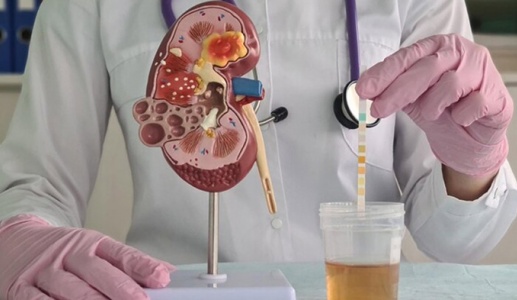 Các yếu tố nguy cơ gây sỏi thận 