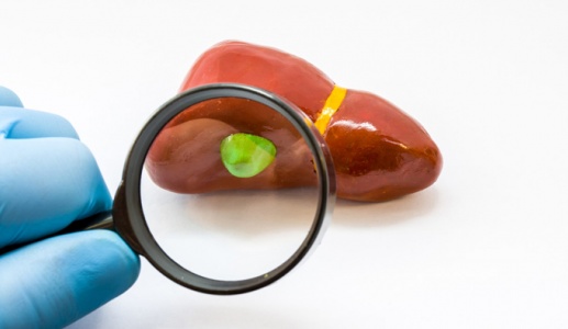 Polyp túi mật có nguy hiểm không?