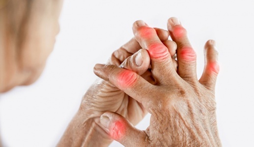 6 bí quyết kiểm soát acid uric, ngăn chặn cơn đau gout cấp