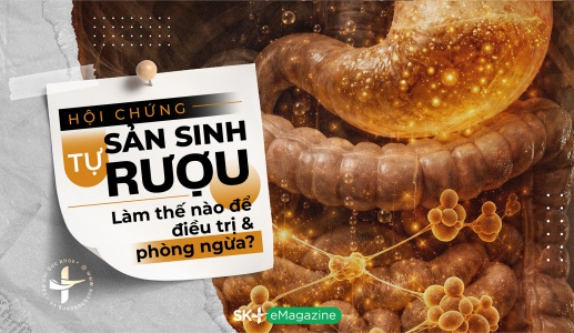 Hội chứng tự sản sinh rượu: Làm thế nào để điều trị và phòng ngừa?