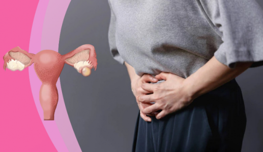 Giải pháp giúp kiểm soát u nang buồng trứng an toàn 