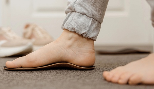 Nguy cơ sức khỏe đi cùng đôi bàn chân bẹt