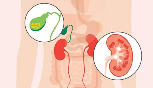 Sỏi mật có gây ra các vấn đề về đường tiết niệu không?