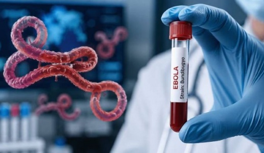 Biết gì về virus Bundibugyo có liên quan đến dịch Ebola?