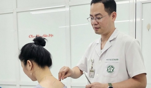 Điều trị đau cổ vai gáy bằng Y học cổ truyền