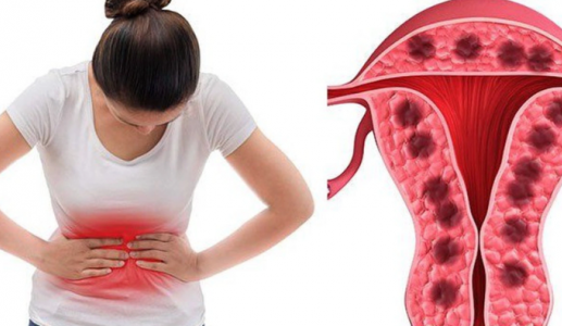 Một số bệnh phụ khoa có thể làm tăng nguy cơ bệnh tim và đột quỵ?
