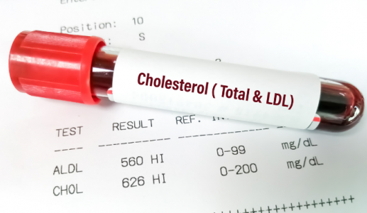Ăn uống bình thường vẫn tăng cholesterol máu: Nguyên nhân từ đâu?