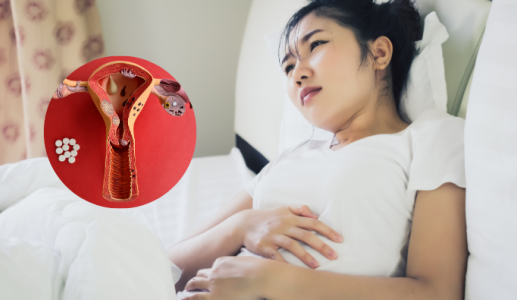 Đột phá điều trị lạc nội mạc tử cung bằng sóng cao tần