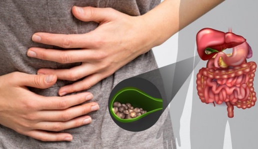 Sỏi mật gây đau bụng, đầy trướng và chậm tiêu xử trí thế nào?