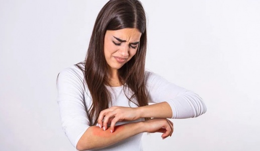 Vảy nến và những ảnh hưởng ít ai ngờ tới