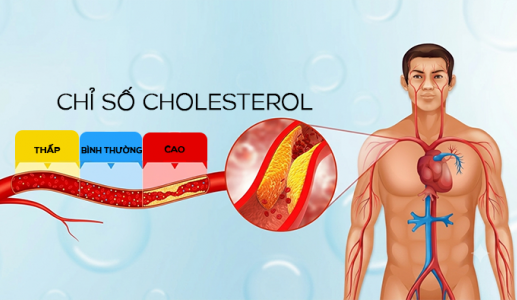 Tăng cholesterol kéo dài: Mối nguy âm thầm thúc đẩy xơ vữa động mạch