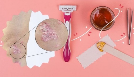 Mẹo tẩy lông an toàn cho người bệnh vảy nến
