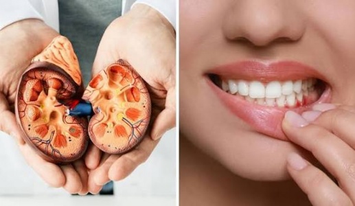 Từ chảy máu chân răng đến nguy cơ tổn thương thận