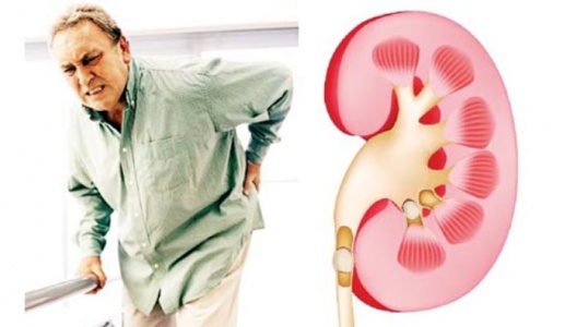 Suy thận mạn ở người cao tuổi: Làm sao để giữ thận khỏe lâu hơn?