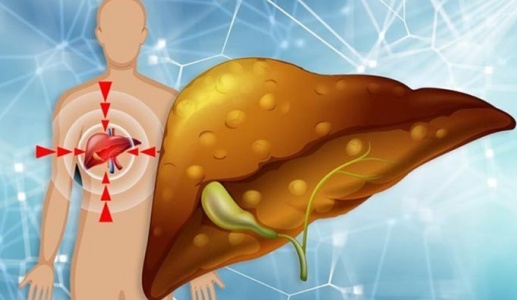 Có thể đảo ngược gan nhiễm mỡ mà không dùng thuốc?