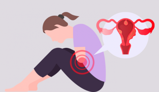 Nhân xơ tử cung có phải ung thư?
