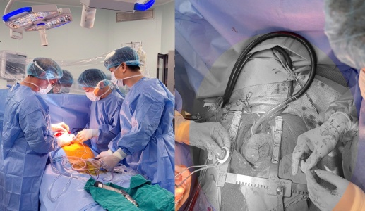 Việt Nam lần đầu cấy ghép thành công thiết bị hỗ trợ tim thế hệ mới CorHeart 6 