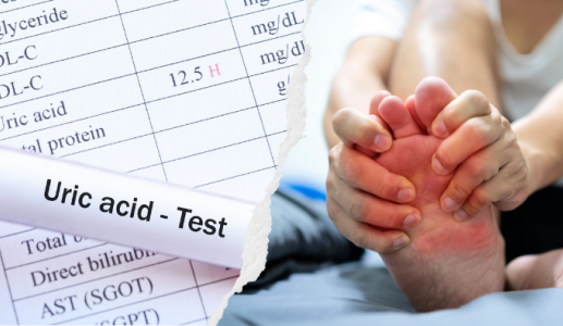 Kiểm soát tốt acid uric trong máu để tránh gặp những cơn gout cấp